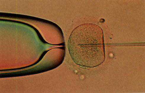 染色体异常的胎停_子宫角切除怀孕吗_「孕期」试管婴儿放几个胚胎备孕期可以