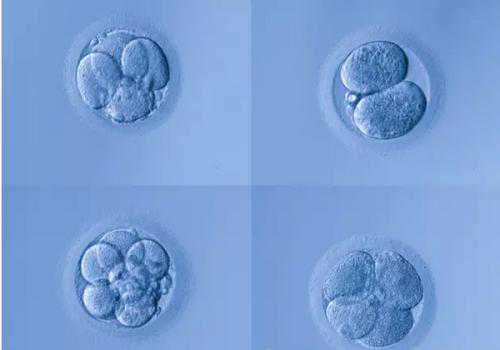 胎停8染色体异常_染色体异常做试管_IVF（试管婴儿）的宫外孕？