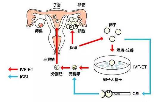 染色体异常能试管_子宫切除怎样怀孕_中国试管发生的那些大事,首个试管婴儿诞